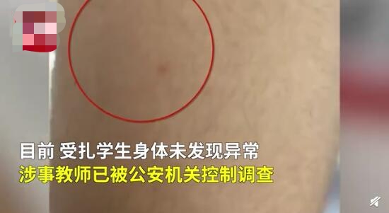 广州一老师用圆规扎学生什么情况？事件详情背后真相曝光